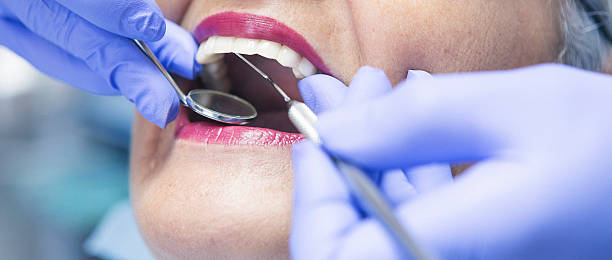 Best Chipped Tooth Repair Near Me  in Effort, PA